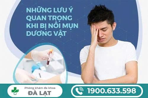 Hình ảnh minh họa